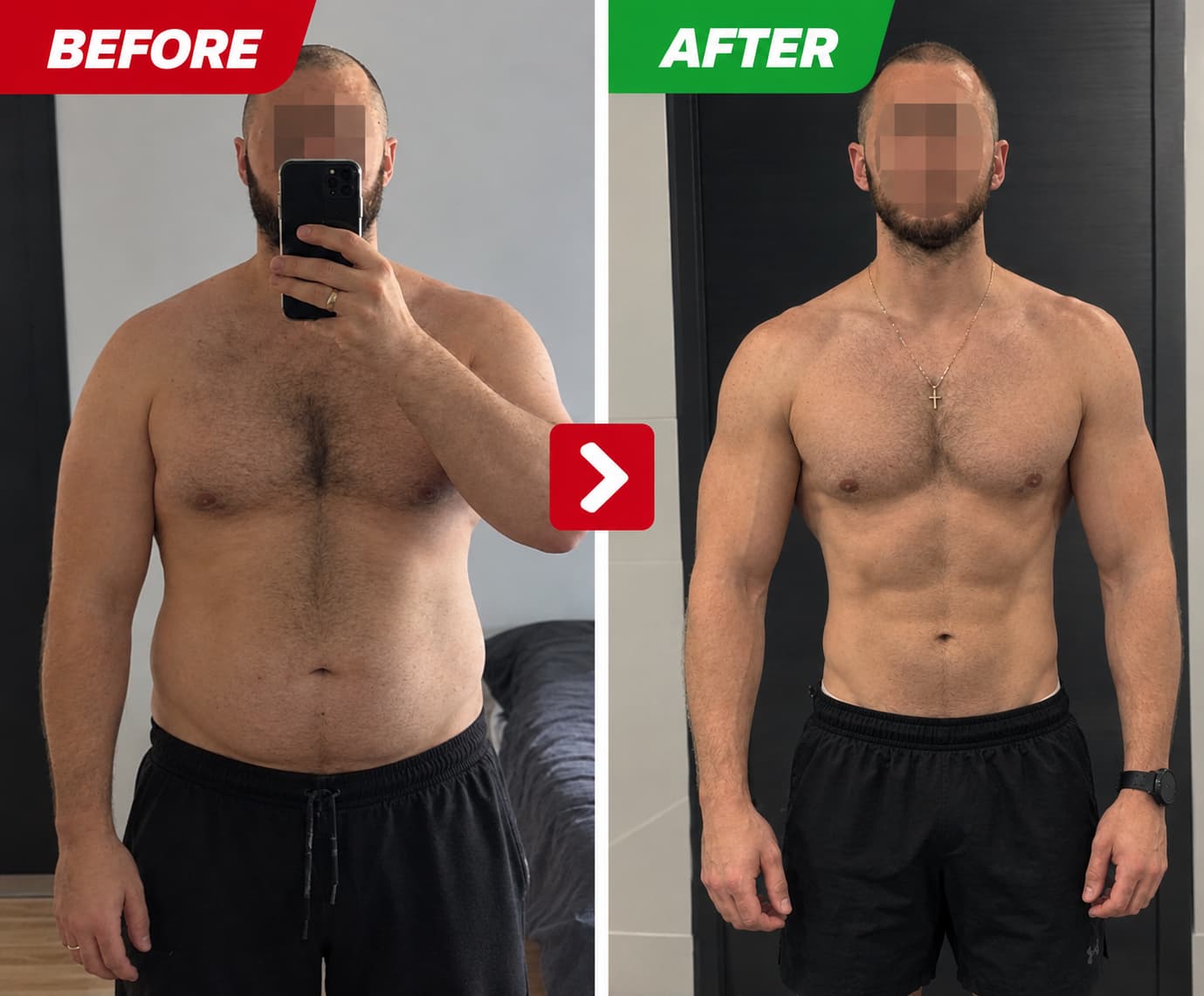 nicholas before after